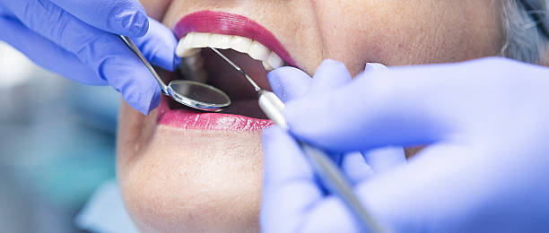 Best Knocked-Out Tooth Emergency  in London, OH